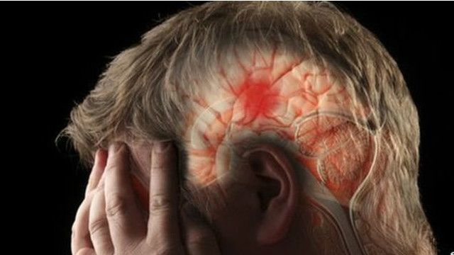 طبی ماہرین نے کینسر کے علاج کا ایک نیا اور آسان ذریعہ دریافت کرلیا