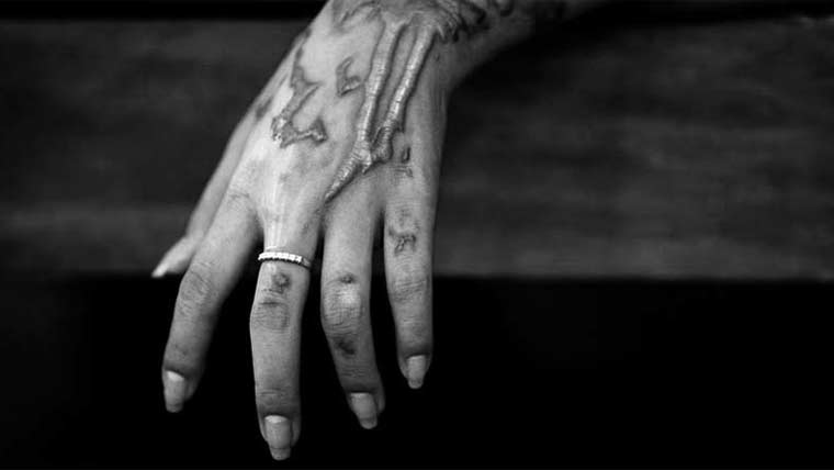 اوکاڑہ: شوہر نے جھگڑے پر بیوی پر تیزاب پھینک دیا