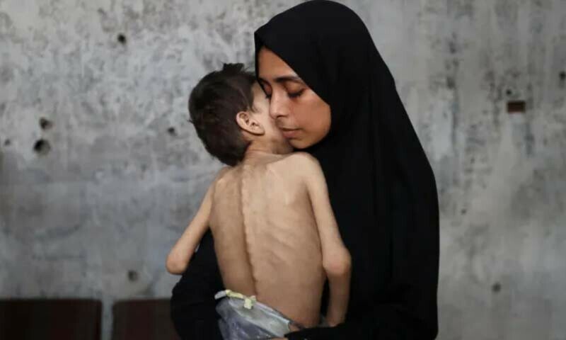 غزہ: بھوک سے مزید 9 اموات، اسرائیلی حملوں میں 24 گھنٹے کے دوران 52 فلسطینی شہید